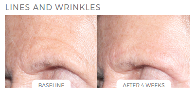 How to build a simple Anti-Aging skincare routine